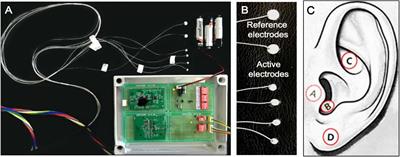 Direct and Transcutaneous Vagus Nerve Stimulation for Treatment of Tinnitus: A Scoping Review